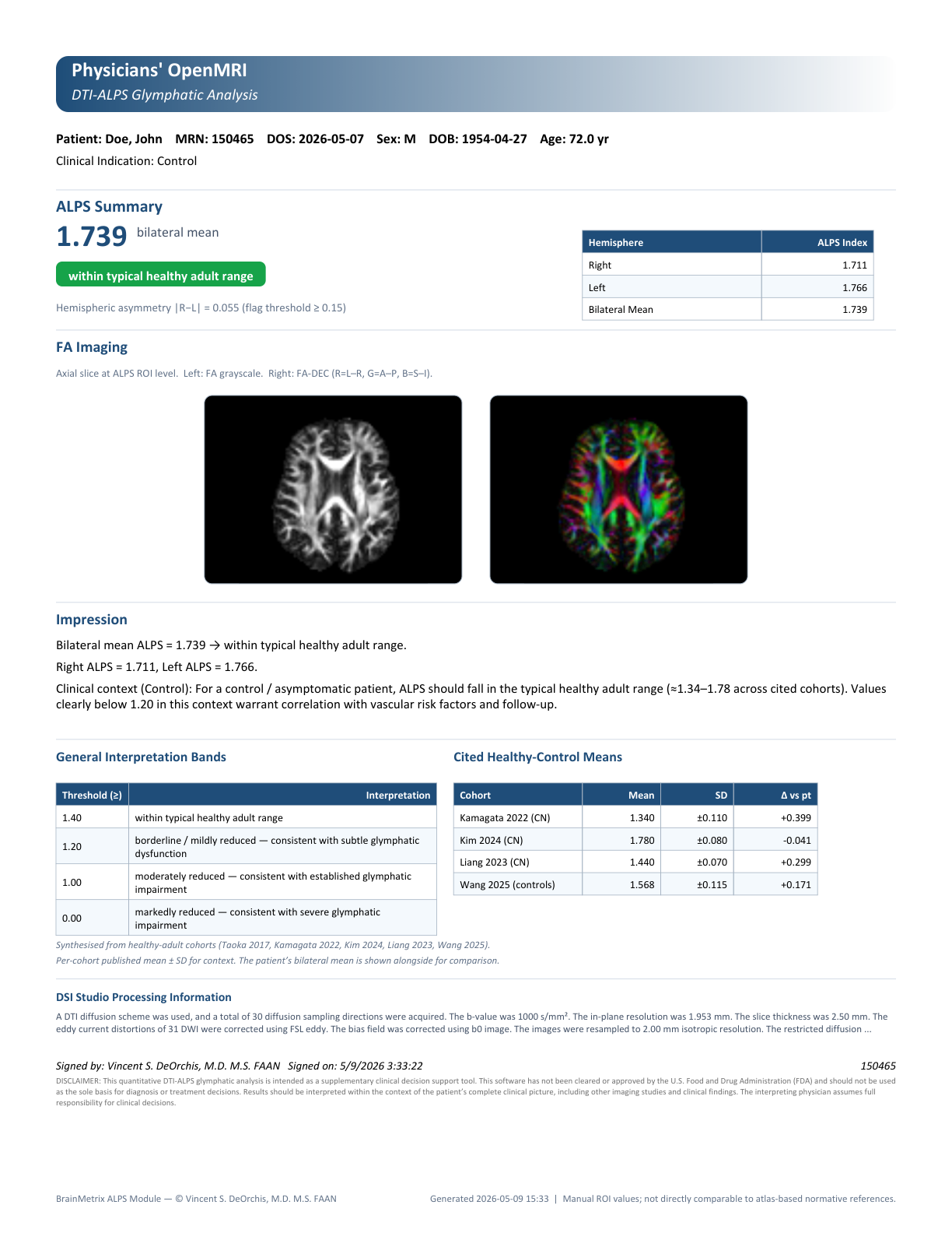 Sample DTI-ALPS Glymphatic Analysis report showing bilateral ALPS index, hemispheric values, interpretation bands, and comparison against published healthy-control cohorts